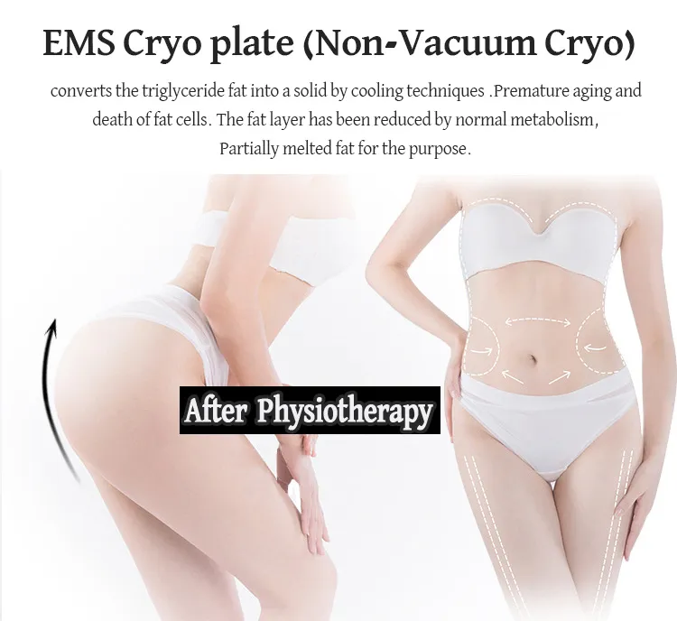 Máquina Portátil de Congelamento de Gordura para Emagrecimento e Remoção de Celulite, Dispositivo de Crioterapia com Placas Cryo e EMS