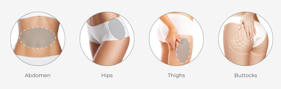 Melhor preço máquina de emagrecimento cryolipólise crioterapia perda de peso congelamento de gordura