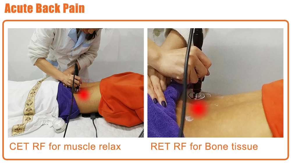 Terapia Tecar Physio Monopolar RF Resistiva e Capacitiva Máquina Tecarterapia Profissional