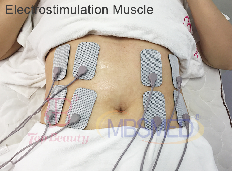 Máquina de Fisioterapia Corporal Escultura Estimulador Muscular Eletro Radiofrequência Indiba para alívio da dor Terapia de 448KHZ Indiba Tecar