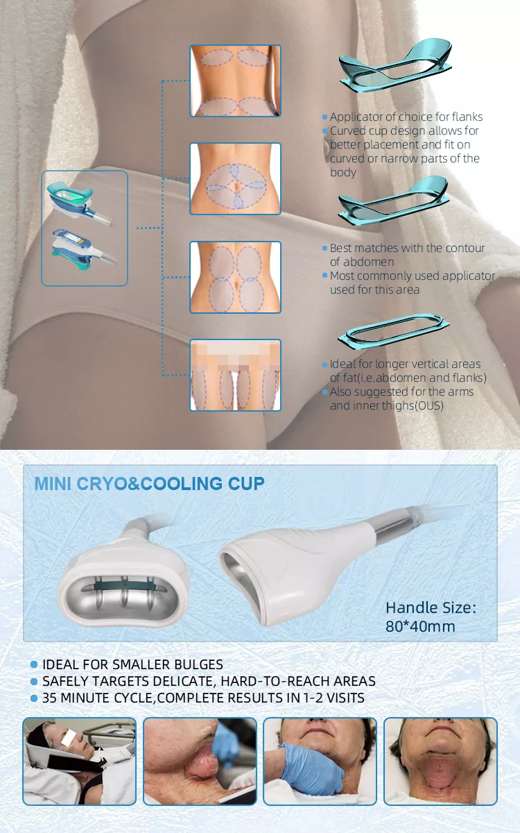 Venda da fábrica de 2022 Máquina de redução de gordura por criolipólise 360 / Máquina de congelamento de gordura Tecnologia Cool Redução de celulite