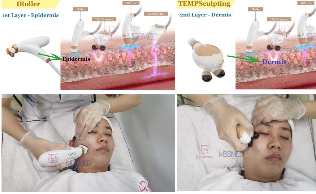 Máquina HIFU 12D ICE para levantamento facial, aperto da pele HIFU