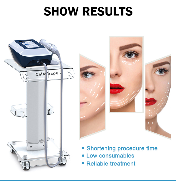 5 Cabeças para Equipamento de Beleza Facial Frequência de Rádio RF Levantamento Facial e Rejuvenescimento Remoção de Rugas Aparato de Rejuvenescimento da Pele RF
