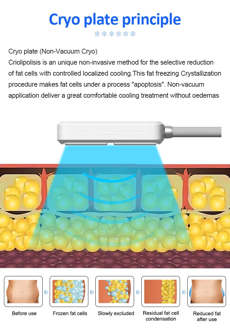Máquina Portátil de Congelamento de Gordura para Emagrecimento e Remoção de Celulite, Dispositivo de Crioterapia com Placas Cryo e EMS