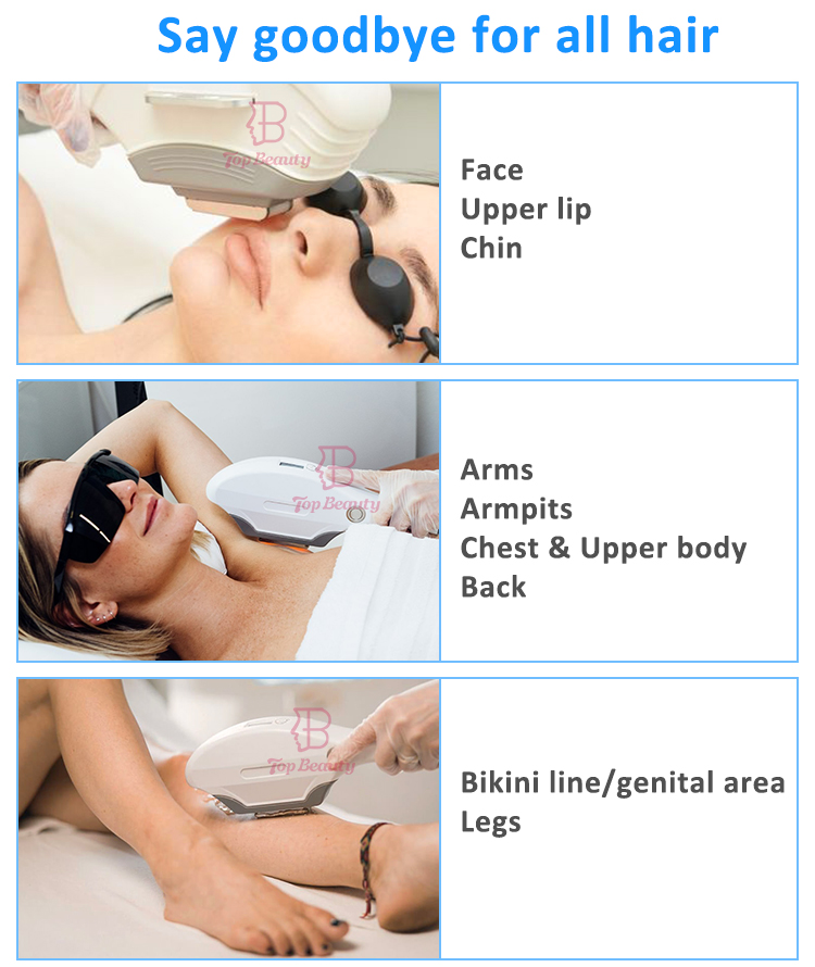 Nova máquina de remoção de cabelo IPL de terapia de luz pulsada intensa