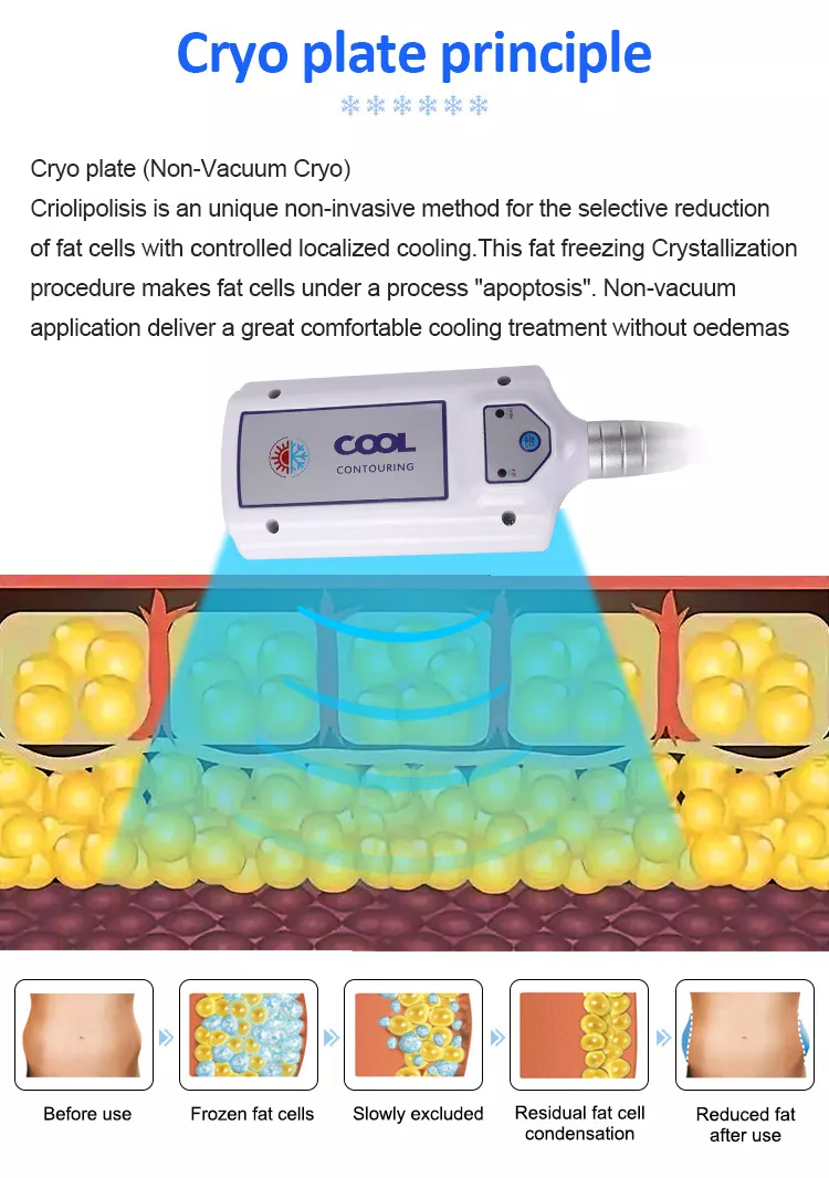 Máquina de Emagrecimento com Placas Crio 2023 Nova Máquina de Criolipólise Coldtec Dispositivo de Criolipólise de Congelamento de Gordura