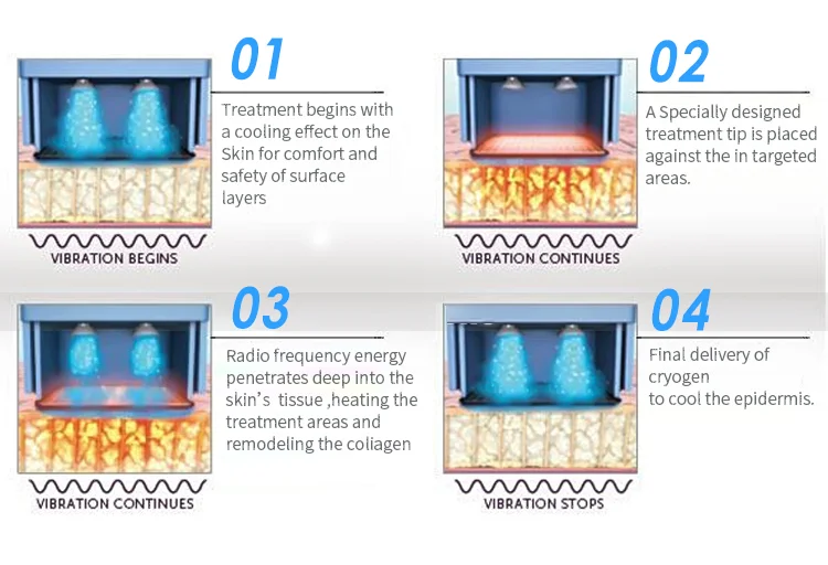Máquina de rejuvenescimento da pele rf de levantamento facial Flx 2 em 1 de 2024 para aperto da pele