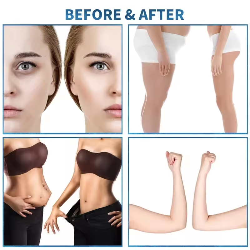 Redução de celulite Contorno corporal Drenagem linfática Rotação de 360 graus Emagrecimento Massagem com rolo de esfera interna 6D