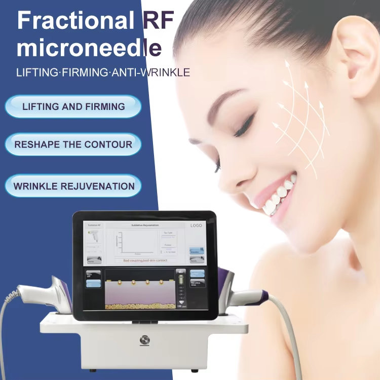 Sistema de RF Microagulhas + Thermagia Fractional RF para Microneedling de RF e Equipamento de Beleza com Frequência de Rádio Fracionada