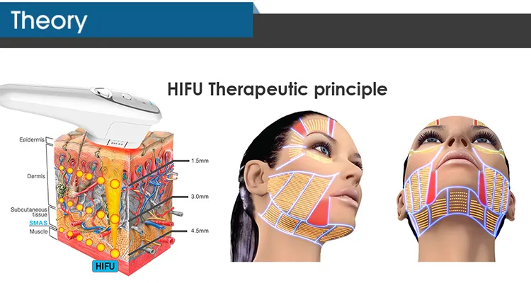 Exibição de rotação de 360 ° ultrassom rejuvenescimento da pele Remoção de rugas vertical Máquina 4D MMFU