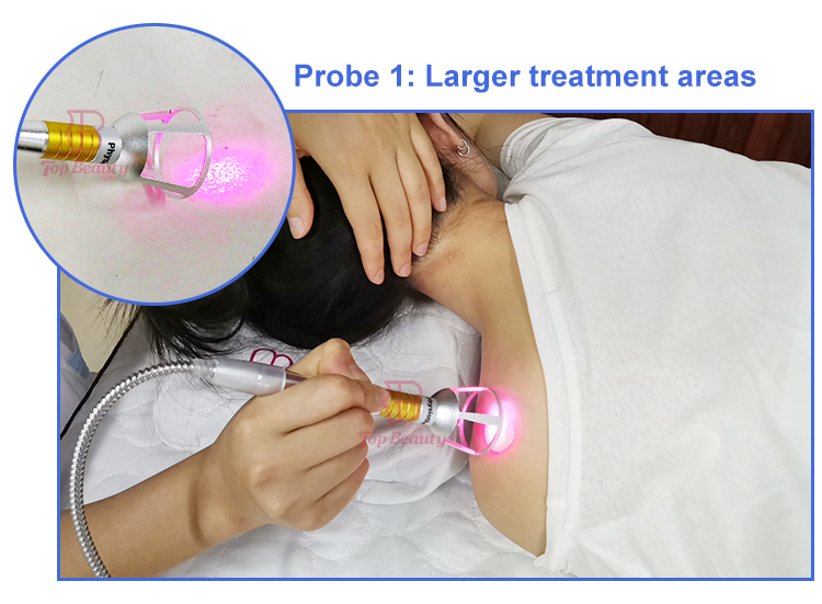 tratamento a laser
