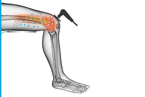 Tecar 2.1 Fisioterapia cet ret rf terapia alívio de dor fisioterapia inteligente 448khz Máquina tecar