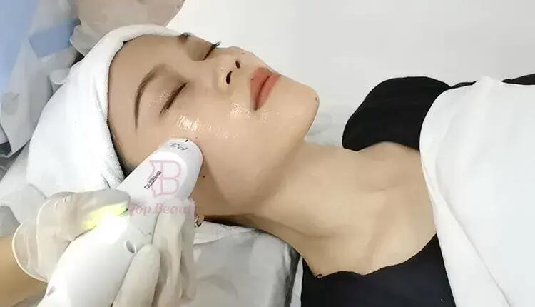 Máquina de Radiofrequência Mmfu Cyclone Rf Levantamento Facial Indolor Máquina Rf Para Remoção de Rugas e Estiramento da Pele