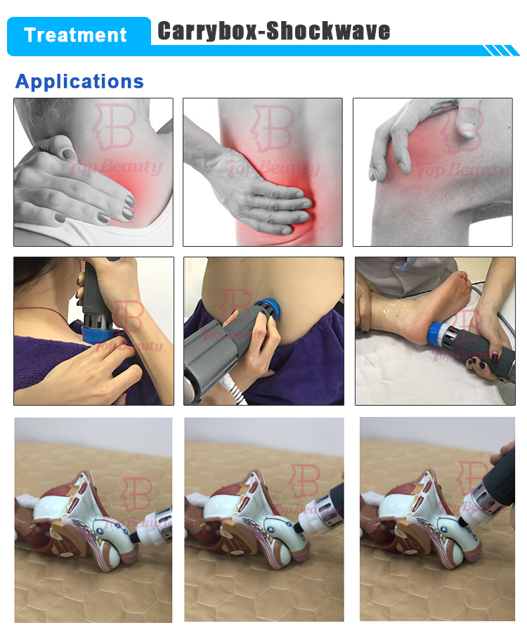 Máquina de Terapia de Onda de Choque Eletromagnética Fswt para Disfunção Erétil e Alívio da Dor