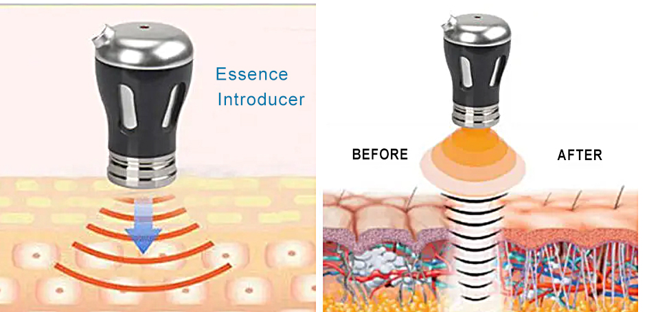 Dispositivo de beleza RF 2 em 1 importado Dispositivo de beleza EMS máquina anti-envelhecimento dispositivo de levantamento facial remover rugas Máquina de Terapia EMS por Ultrassom
