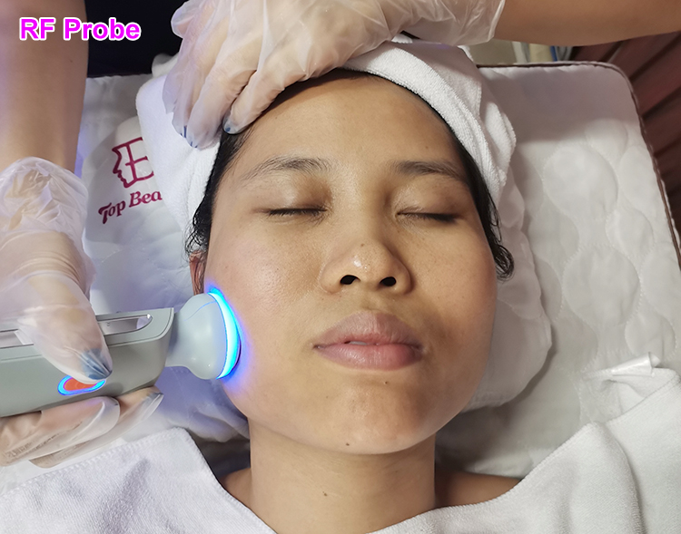 Dispositivo de Dermabrasão Facial Hidro com jato de água e oxigênio Anti-Envelhecimento Hidrodermoabrasão Cuidado com a pele do rosto