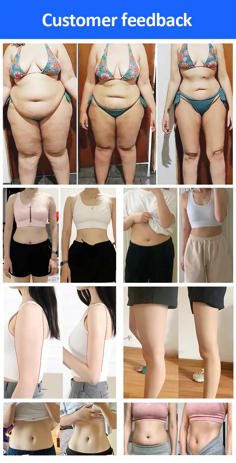 Máquina Portátil de Congelamento de Gordura para Emagrecimento e Remoção de Celulite, Dispositivo de Crioterapia com Placas Cryo e EMS