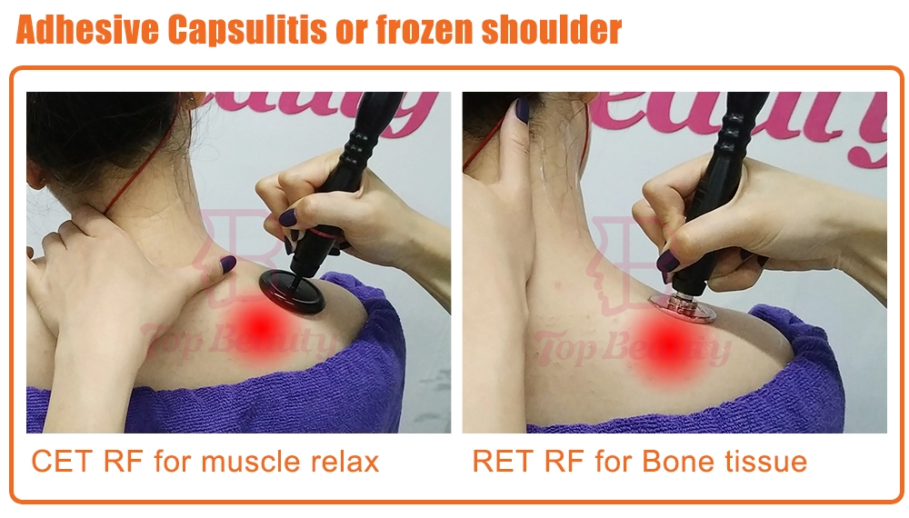 Terapia Tecar Physio Monopolar RF Resistiva e Capacitiva Máquina Tecarterapia Profissional