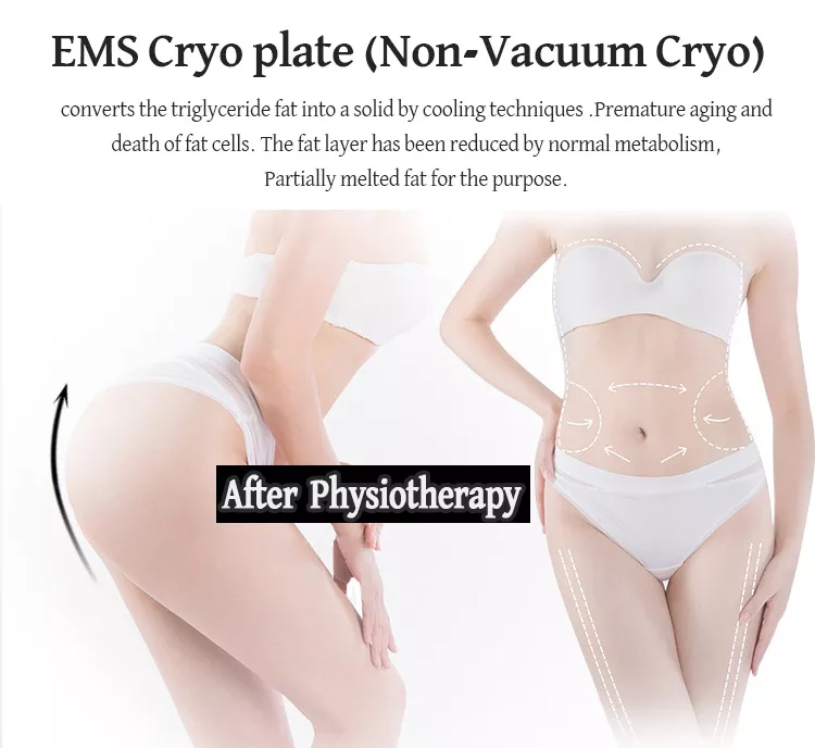 2023 Novo Cryolipólise Indolor para Emagrecimento da Barriga Placas de Resfriamento Cryo Almofadas de Congelamento de Gordura Máquina EMS