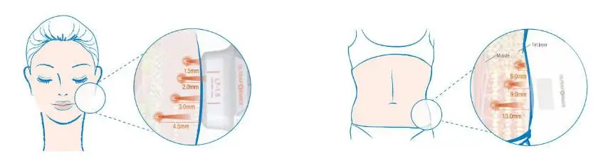 Máquina de rejuvenescimento da pele rf de levantamento facial Flx 2 em 1 de 2024 para aperto da pele