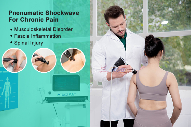 Terapia por Ondas de Choque para Disfunção Erétil