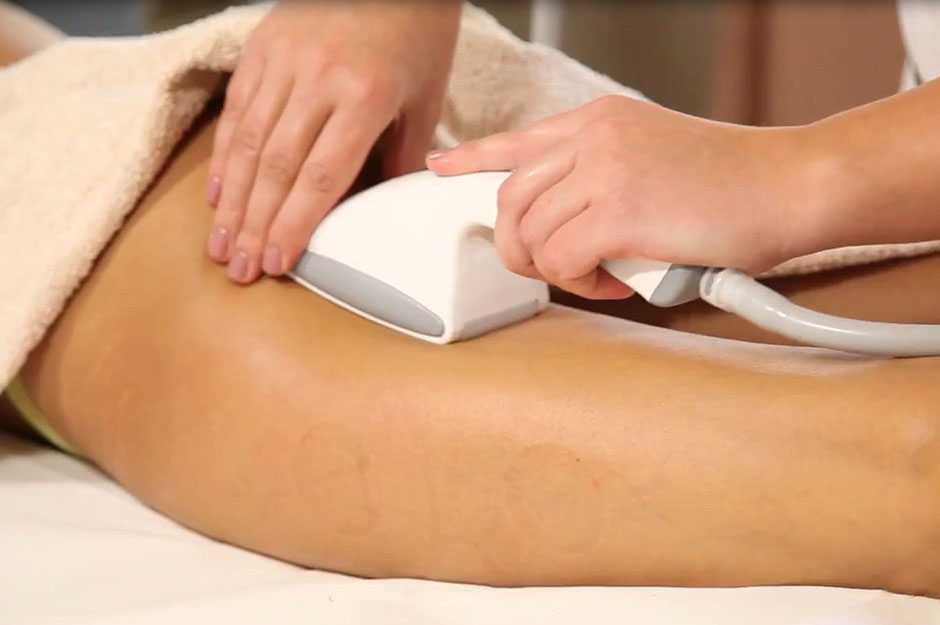 Máquina de terapia a vácuo com tela sensível ao toque starvac sp2 terapia de copo a vácuo emagrecimento