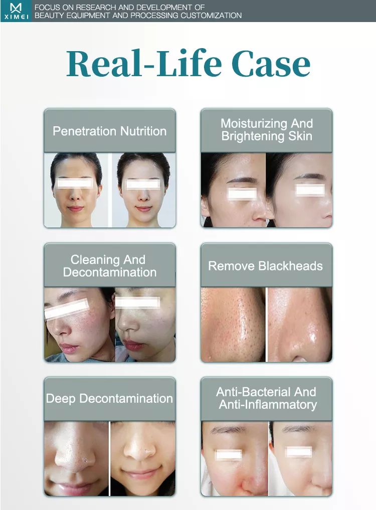 Dispositivo de jato de peeling facial aqua 6 em 1 com limpeza facial a vácuo e hidrodemabrasão para SPA