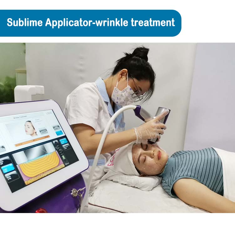 Remoção de rugas da pele com Matrix de Microneedling por Radiofrequência (RF)