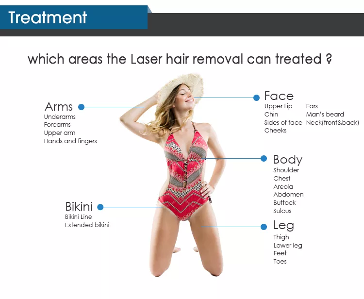 Imagem de tratamento a laser