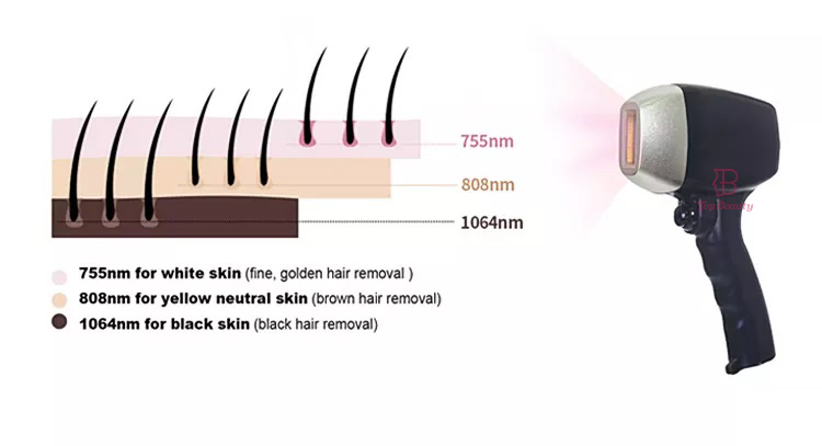 Máquina profissional de remoção de pelos a laser de diodo 808nm