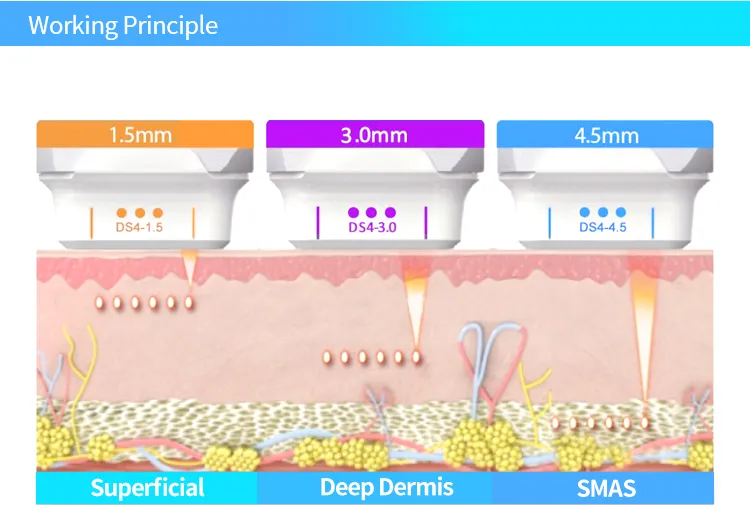 Exibição de rotação de 360 ° ultrassom rejuvenescimento da pele Remoção de rugas vertical Máquina 4D MMFU