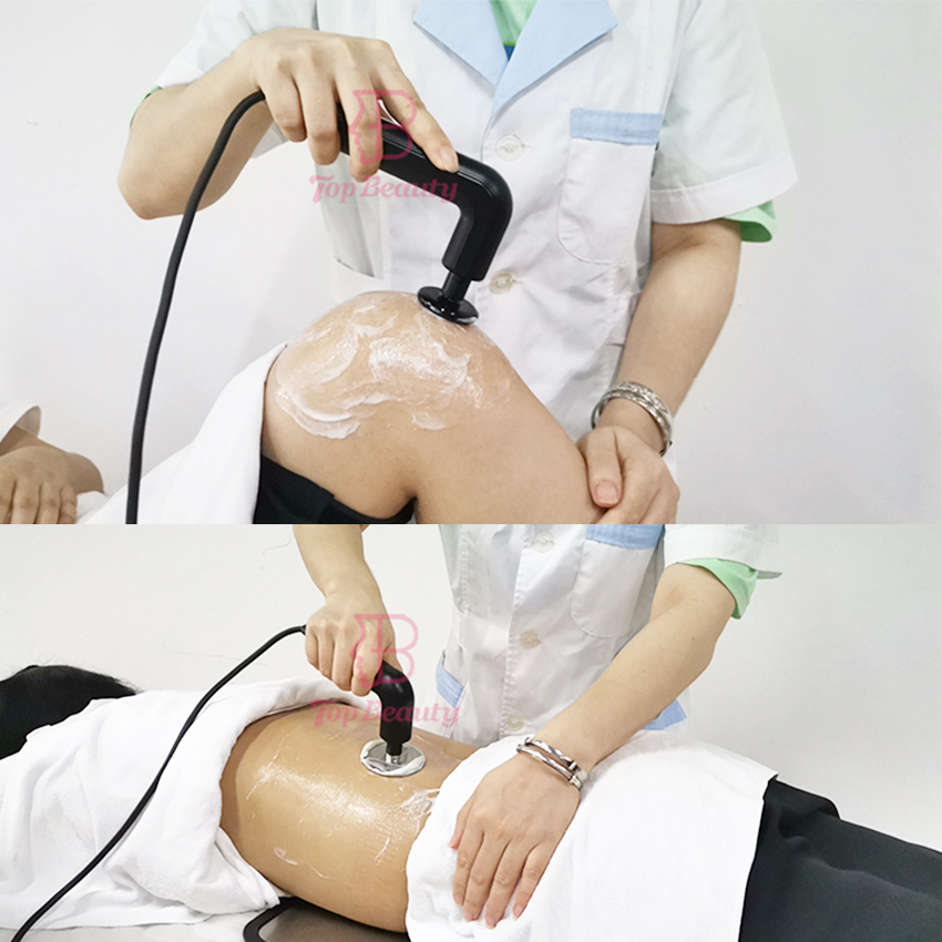 Máquina Inteligente de Diatermia Indiba Tecarterapia Rf para Queima Profunda de Gordura Tecar Fisioterapia