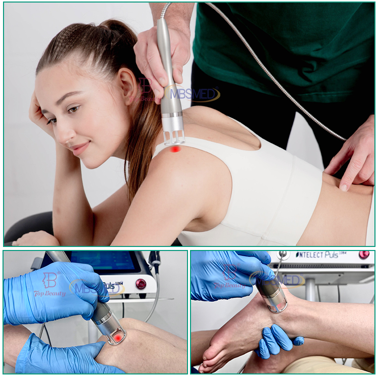 Terapia a Laser de Classe 4 de Onda de Choque Profissional para Terapia de Onda de Choque de Reabilitação Eswt