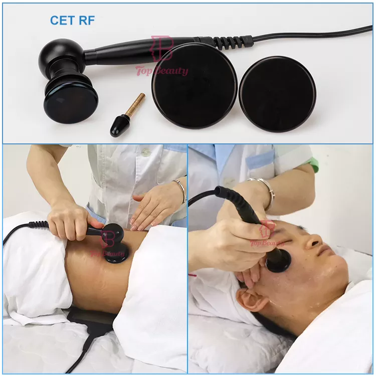 Outra imagem de aplicação da CET RF