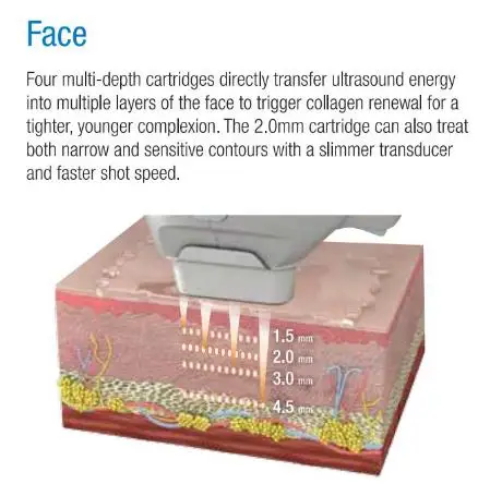 Máquina de rejuvenescimento da pele rf de levantamento facial Flx 2 em 1 de 2024 para aperto da pele