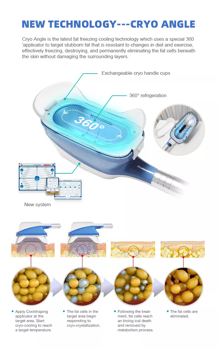 Máquina Cryo 360 de 2022 Cryolipólise Melhor Preço Máquina de Congelamento de Gordura Para Perda de Peso Cryolipólise