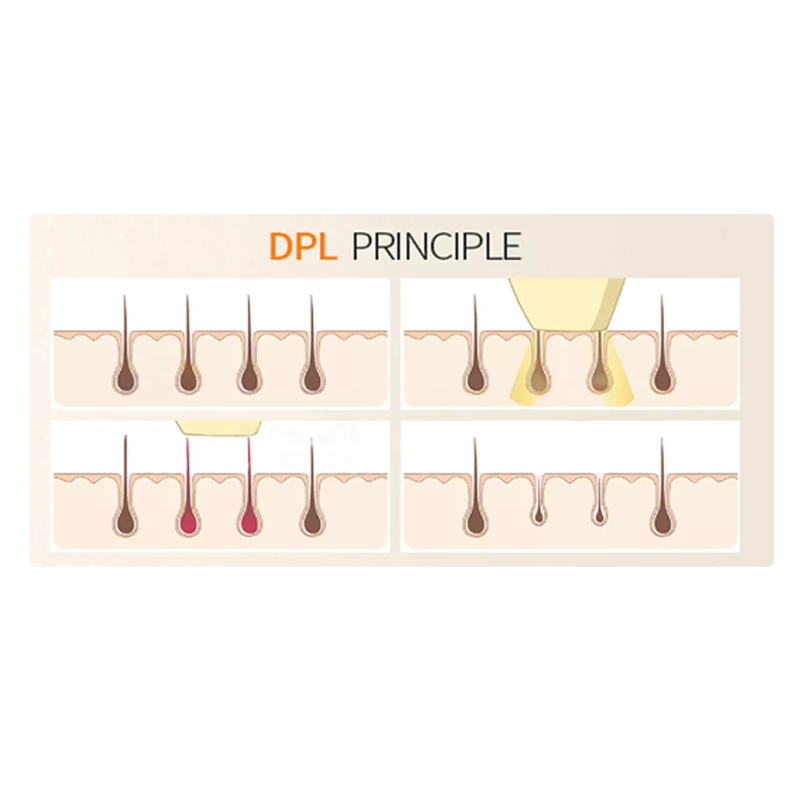 máquina de depilação a diodo DPL rejuvenescimento da pele lifting anti-rugas e máquina de beleza