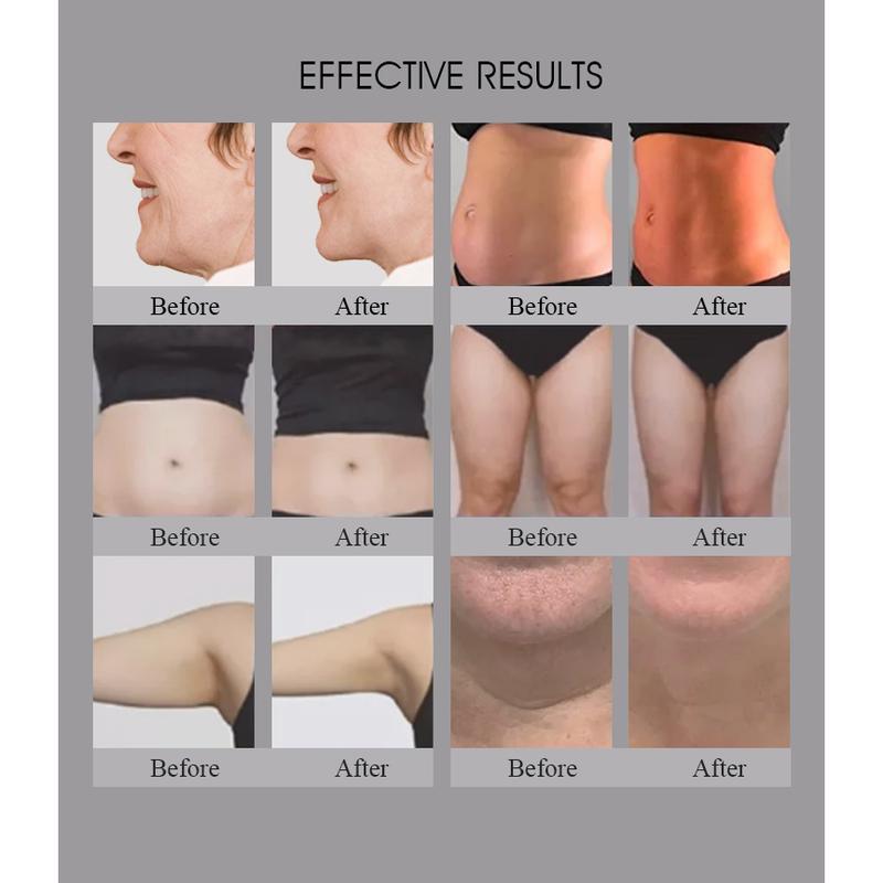 3 em 1 Trusculpt Id Flex Rf Body Contouring Body Sculpting 2mhz Tratamento de Celulite Redução de Gordura Trufat Machine para uso em Salão