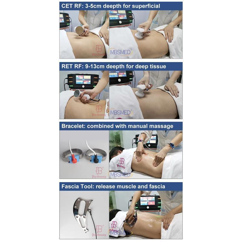 Terapia de Radiofrequência indiba Cet Ret Tecar Indiba 448Khz Máquina de Terapia Tecar