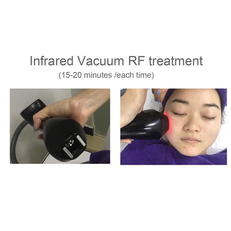 Redutor de Gordura 2023 Novo Sistema de Massagem a Vácuo para Modelagem Corporal