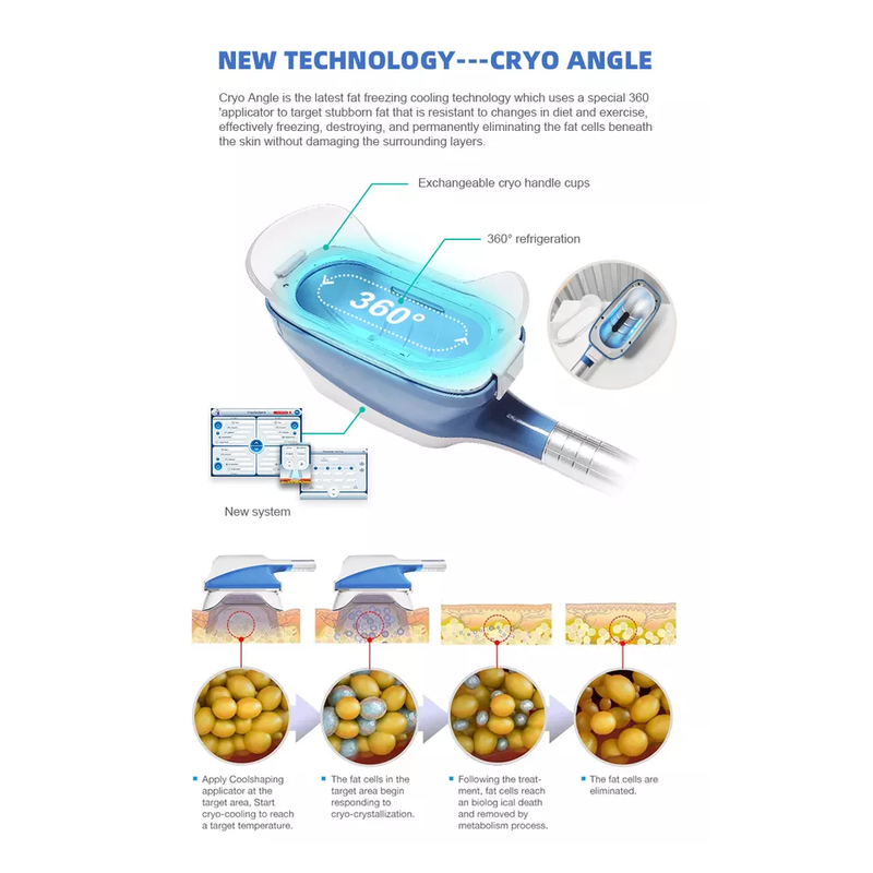 Máquina Cryo 360 de 2022 Cryolipólise Melhor Preço Máquina de Congelamento de Gordura Para Perda de Peso Cryolipólise