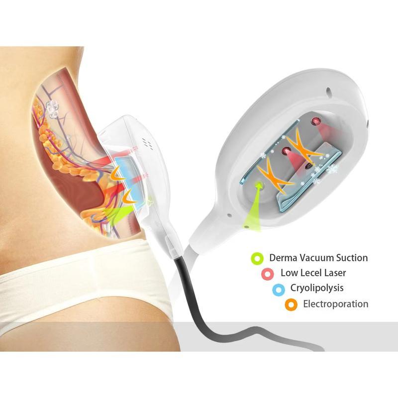 Melhor preço máquina de emagrecimento cryolipólise crioterapia perda de peso congelamento de gordura