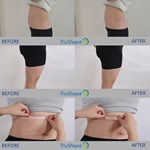 Tratamento Trushape ID Ems Estimulação Elétrica Muscular Escultura Corporal Máquina Emslim