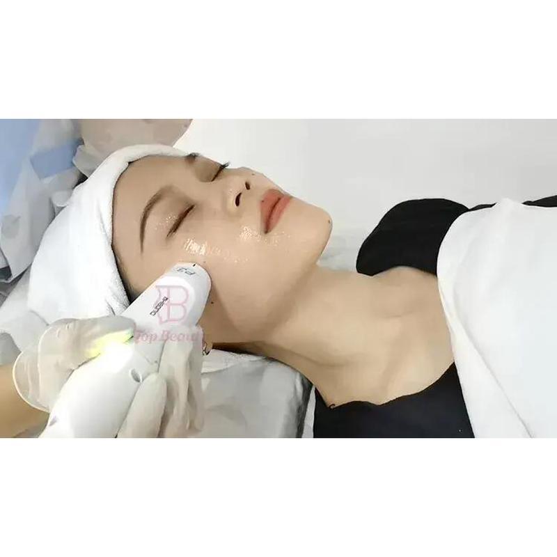 Máquina de Radiofrequência Mmfu Cyclone Rf Levantamento Facial Indolor Máquina Rf Para Remoção de Rugas e Estiramento da Pele