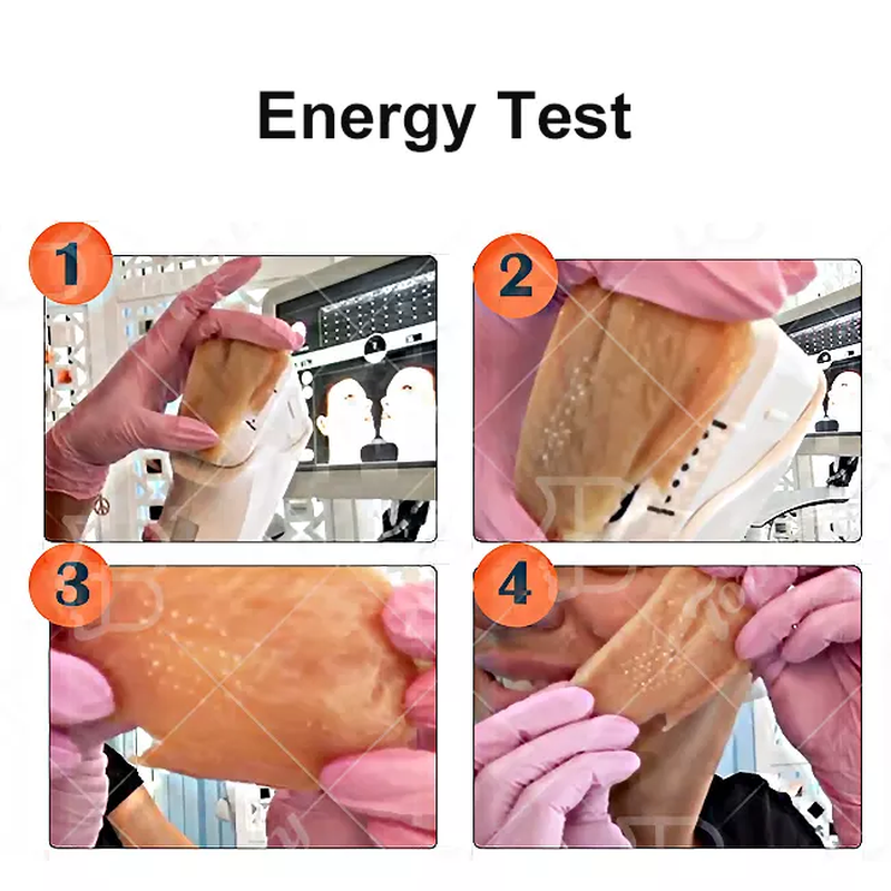 Exibição de rotação de 360 ° ultrassom rejuvenescimento da pele Remoção de rugas vertical Máquina 4D MMFU