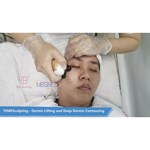 Máquina HIFU 12D ICE para levantamento facial, aperto da pele HIFU