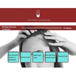 Escova Elétrica Iônica Mini Portátil Anti-Estática para Massagem no Couro Cabeludo Combate à Queda de Cabelo e Tratamento Capilar