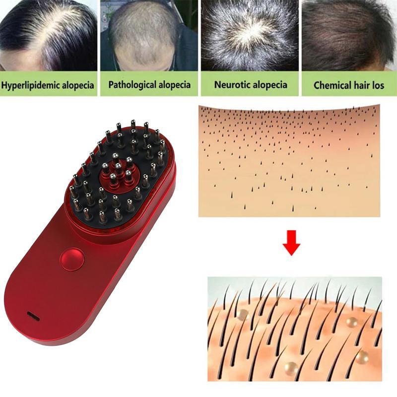 Escova Elétrica Iônica Mini Portátil Anti-Estática para Massagem no Couro Cabeludo Combate à Queda de Cabelo e Tratamento Capilar