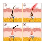 Nova máquina de remoção de cabelo IPL de terapia de luz pulsada intensa