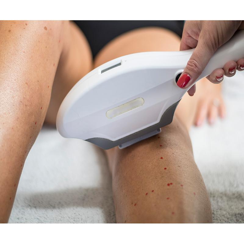 Nova máquina de remoção de cabelo IPL de terapia de luz pulsada intensa